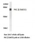 PRKCB / PKC-Beta Antibody (aa621-670)